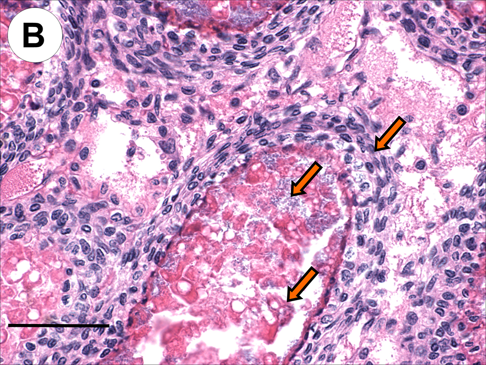 EMS/AHPNS: Infectious disease caused by bacteria - Responsible Seafood ...